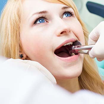 Oral Surgery - Tooth Extraction